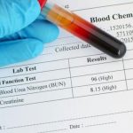 چگونه جواب آزمایش خون خود را بخوانیم؟